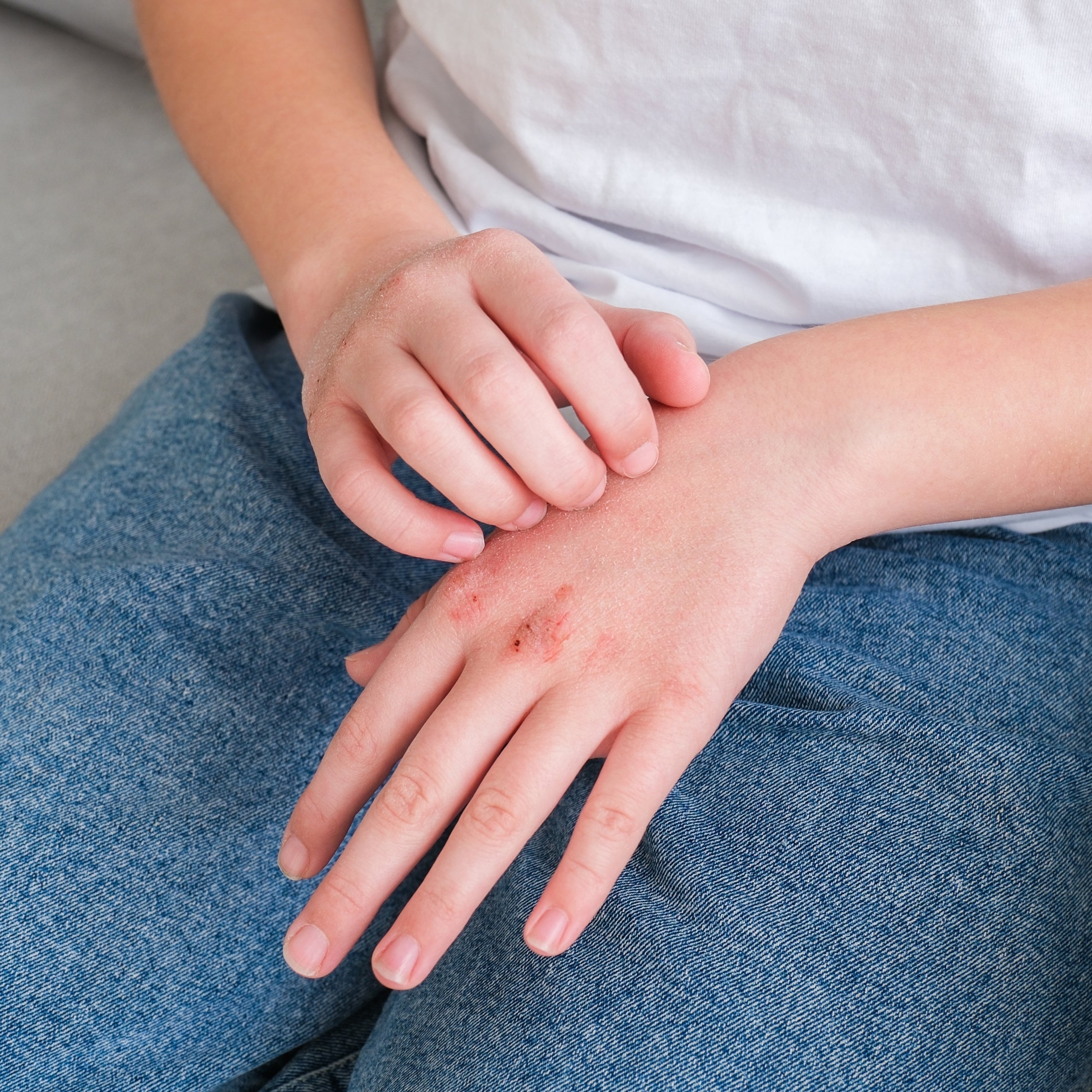 Trockene Haut und Lippen im Winter? Praktische Tipps für dich